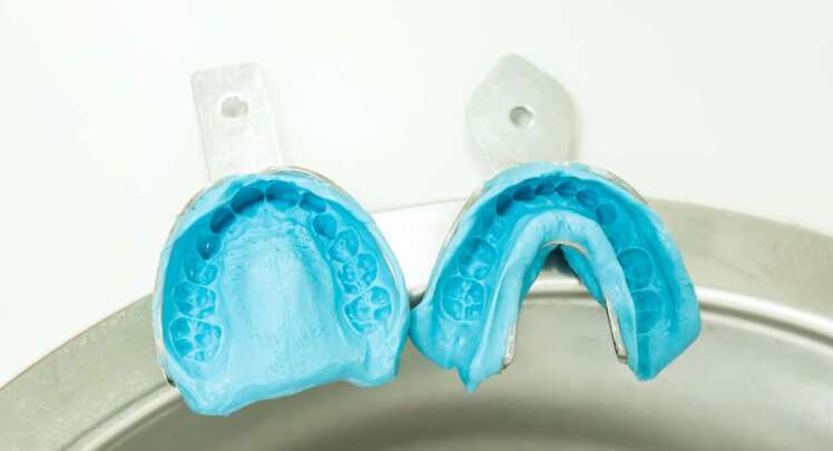 آلژینات دندانپزشکی چیست؟