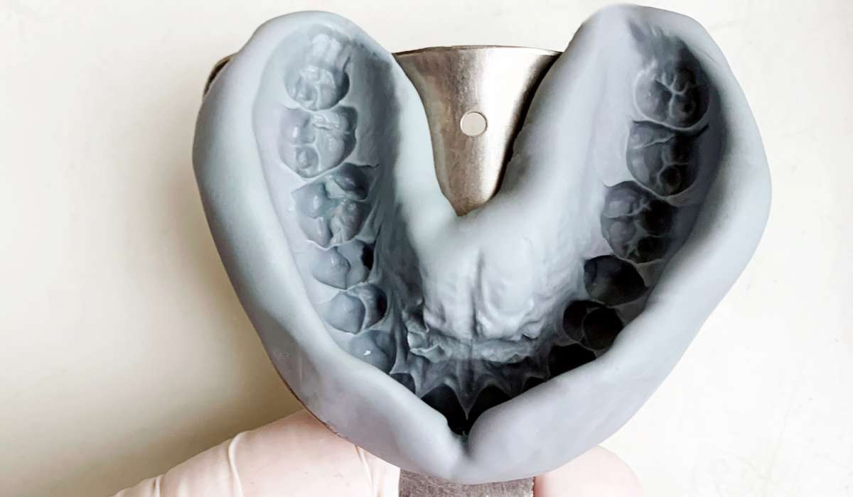 زمان قالبگیری دندان