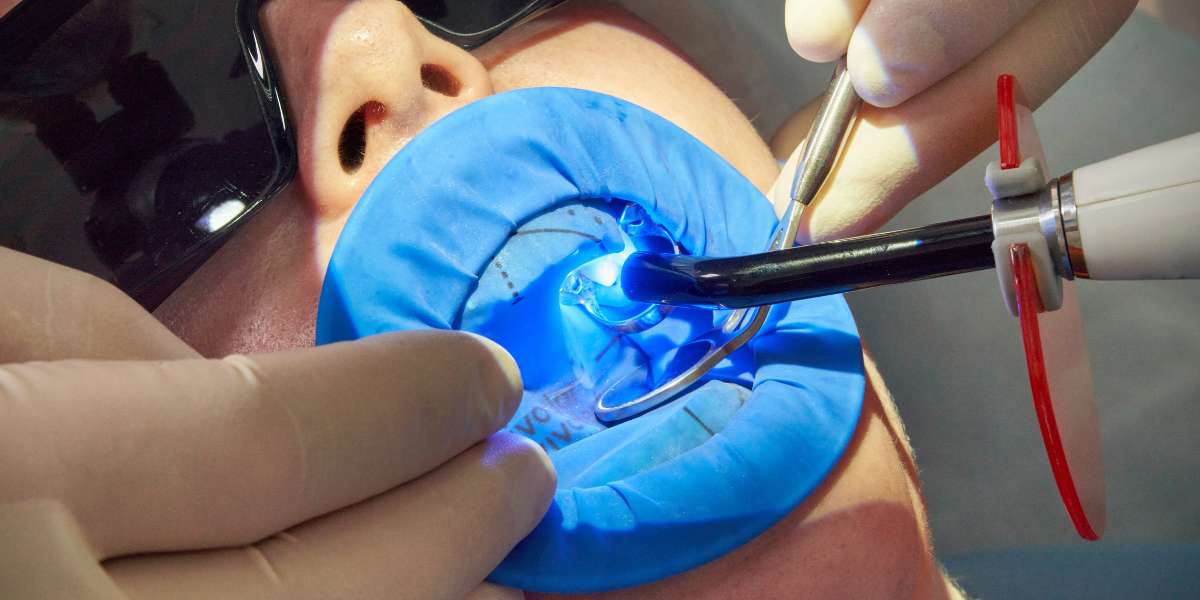 لایت کیور کامپوزیت دندان