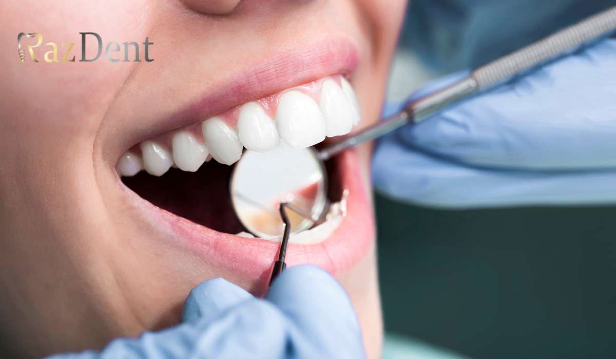 بهترین برند کامپوزیت دندان