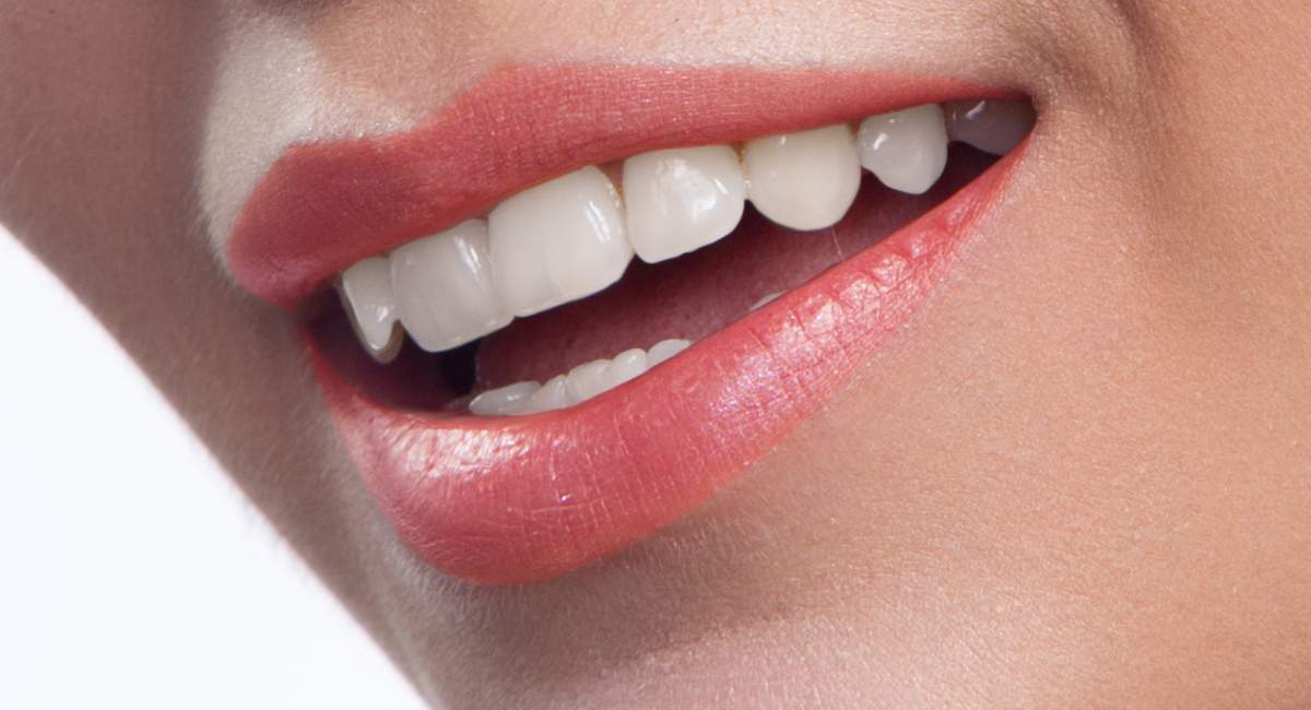 نمونه استفاده از قلم سفید کننده