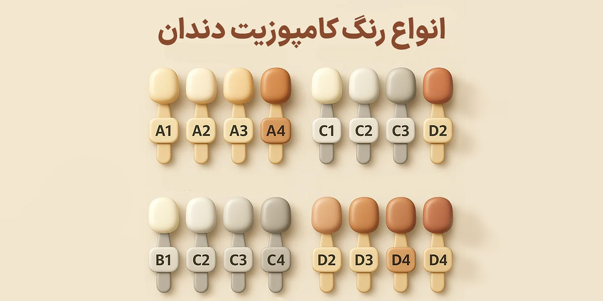 انواع رنگ کامپوزیت دندان