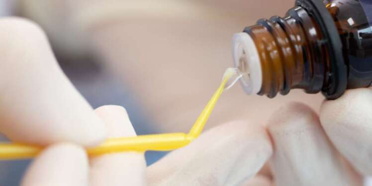 پرایمر دندانپزشکی چیست؟