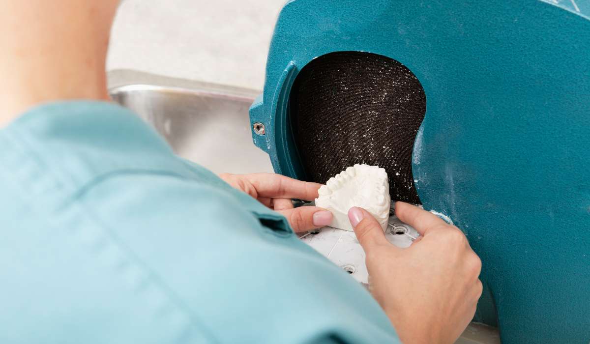 مراحل قالبگیری دندان برای ساخت روکش